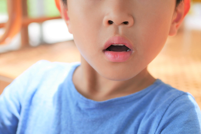 子どもの口腔筋機能療法（MFT）