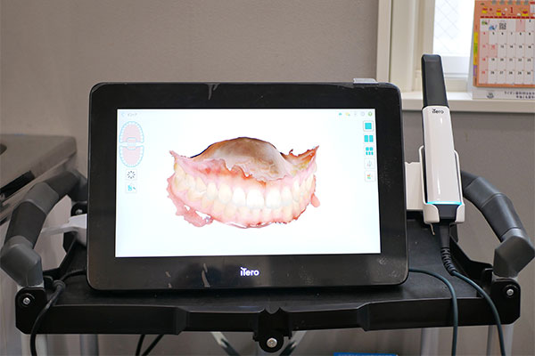 当院では3Dスキャナーを導入しています！